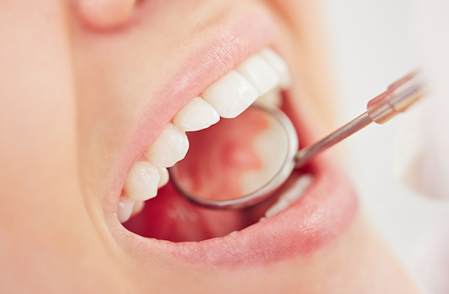 歯科医師、歯科衛生士による口腔内診査